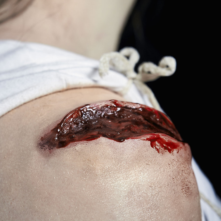 Exit Skin - Flesh Wound