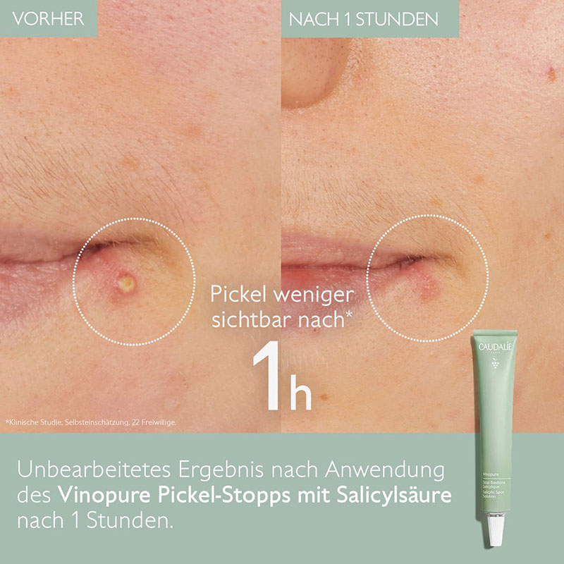 Caudalie - Vinopure Pickel-Stopp Caudalie - Vinopure Pickel-Stopp